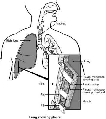 Lungs and airways with pleura