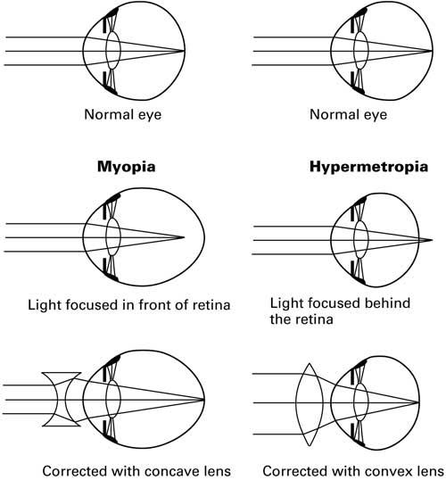 REFRACTION