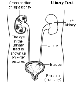 Cross-section diagram of the urinary tract describing how an intravenous urography is performed