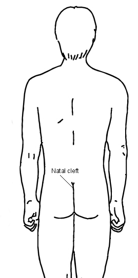 Diagram detailing the natal cleft