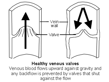 Normal valves