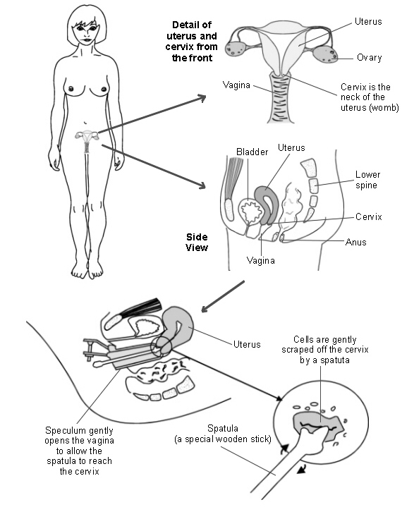 cervical screening test